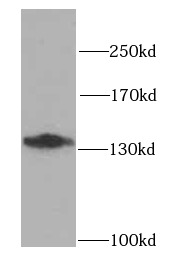 anti- N-cadherin antibody