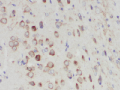      N-cadherin抗體