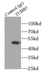      Tubulin-beta抗體