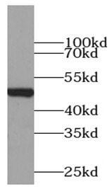      Tubulin-beta抗體